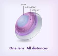 Multifocal Progressive Contact Lenses